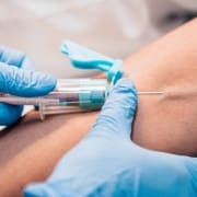A close-up of a healthcare worker from Boss Infusions wearing blue gloves, inserting a needle into a person's arm to draw blood, with a tourniquet tied above the injection site—showcasing IV Infusion Therapy Brisbane.